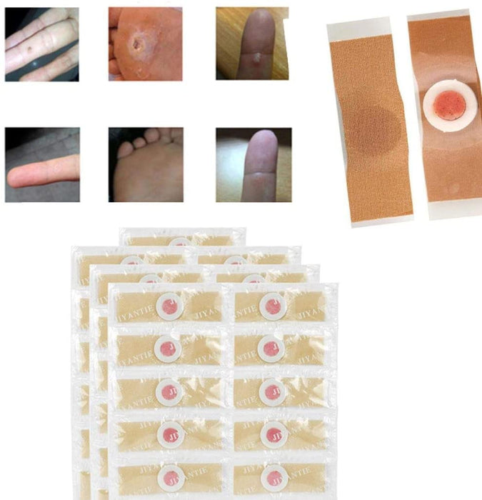 Digital Shoppy 10pcs/lot Foot Corn Killer Calluses Plantar Warts Thorn Pain Relief Plaster Foot Care Tool Medical Sticker Toe Protector