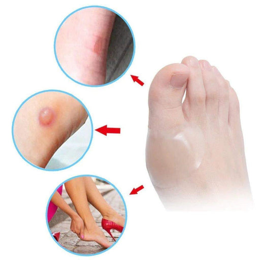 Digital Shoppy  4 PCs Foot Care Skin Hydro colloid Relief Plaster Blister Patch Heel Protector--FREE SHIPPING - digitalshoppy.in