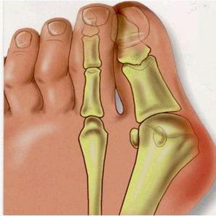 Digital Shoppy 2 pcs for left and right foot Foot Care Tool Regular