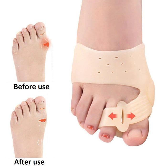 Digital Shoppy Magnetic therapy Silicone Gel Toes Separator Bunion Bone Ectropion Adjuster Toes Outer Foot Care Hallux Valgus Corrector Unisex pressure magnetic women men digital shoppy X001NT1EQ9