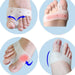 Close-up of a silicone gel thumb valgus protector, designed to prevent bunion progression and provide foot pain relief.